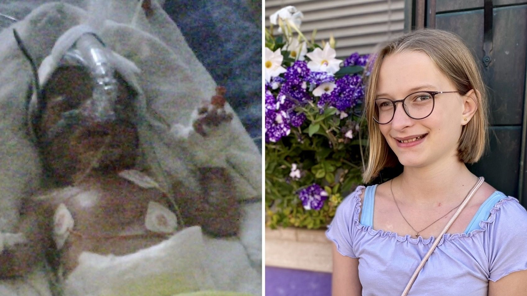 Patientin Leni vorher und nachher