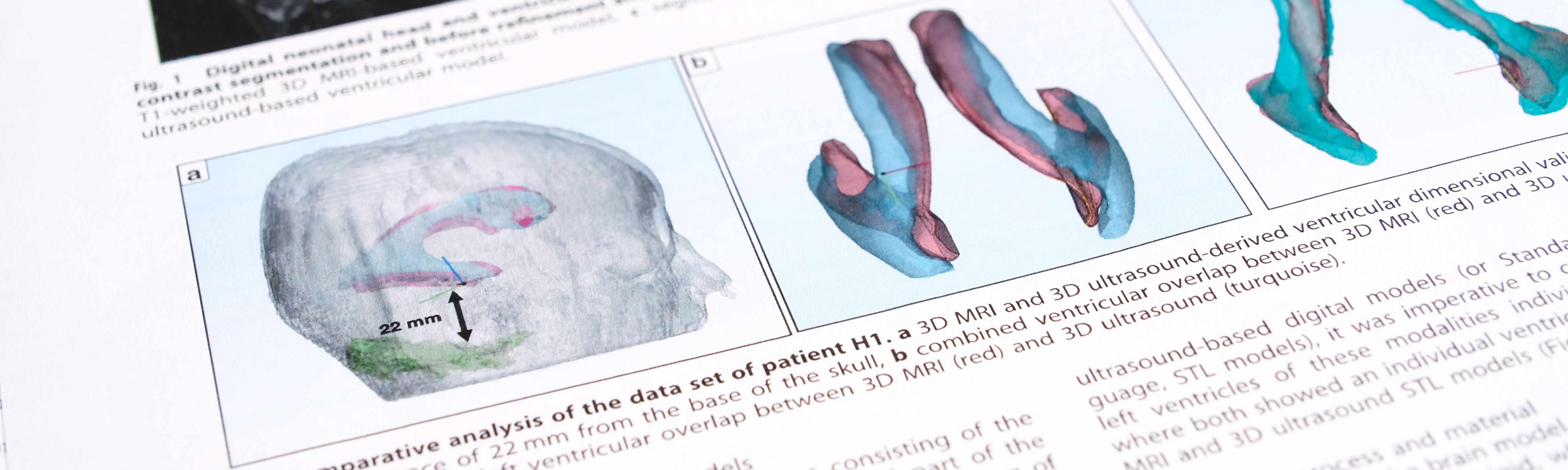 © MedUni Wien / Comprehensive Center for Pediatrics / Mathias Hetzmannseder